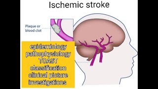 Ischemic stroke symptoms risk factors classification imaging [upl. by Maryjo]