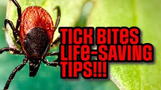 STOP Tick Bites from Becoming Lyme Disease MUST KNOW Bug Bite FACTS [upl. by Heman]