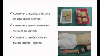 umh1723 201213 Lec015a Electrodiagnóstico de estimulación Metodología de las curvas I  t [upl. by Odele]