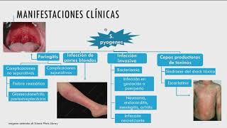 Sesión clínica Retos del Streptococcus Pyogenes en el puerperio [upl. by Nus]