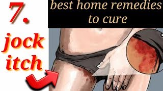 How to cure jock itch fast naturaly  7 best home treatment for jock itch by natural remediestips [upl. by Ledua]