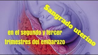 Sangrado uterino en el segundo y tercer trimestres de embarazo [upl. by Sinclair644]