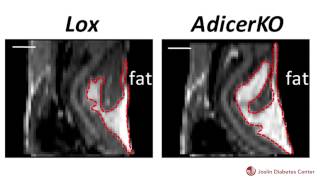 Joslin Scientists Identify Process that Affects Fat Distribution and Metabolic Syndrome [upl. by Henson]