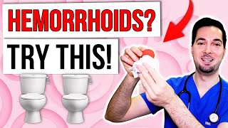 How to get rid of hemorrhoids fast treatment at home naturally [upl. by Irem]