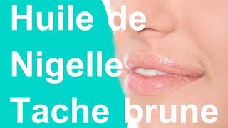 huile de nigelle tache brune [upl. by Rayle273]