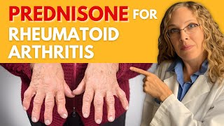 Managing Rheumatoid Arthritis with Prednisone Dosage Effectiveness and Side Effects [upl. by Ahseekal]