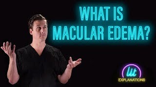 What Is Macular Edema [upl. by Stovall]