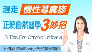 趕走慢性蕁麻疹，正統自然醫學三妙招！ 林侑融 美國自然醫學醫師 EP 29 [upl. by Nigem614]