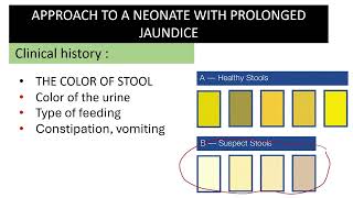 Prolonged Neonatal Jaundice prolonged hyperbilirubinemia Approach to prolonged jaundice [upl. by Clyte]