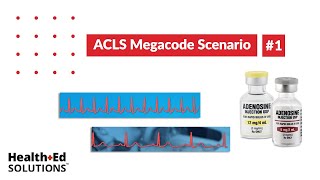 ACLS Megacode Scenario 1 Supraventricular Tachycardia SVT [upl. by Eiddal]