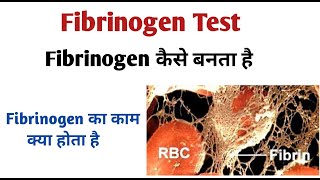 Fibrinogen I fibrinogen blood test [upl. by Tower]