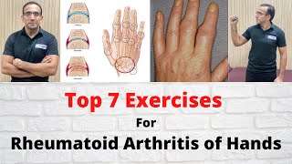 Top 7 Best Exercises for Rheumatoid Arthritis of Hands  Treat Morning Stiffness of RA  UrduHindi [upl. by Arral]