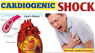 cardiogenic shock circulatory system and disease pathophysiology and cause [upl. by Mari673]