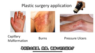 Capillaroscope Essentials 4 Plastic Surgery Research Dr Kento Yamamoto GOKO Webinar for IMC [upl. by Avilys]