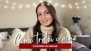 COMO TRATEI O ACNE Ketrel Isotretinoína Espironolactona etc  ESPECIAL DE NATAL 6 [upl. by Jeralee]