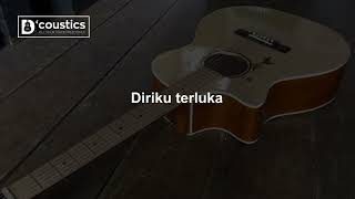 Andra amp The Backbone Musnah Karaoke Akustik Version [upl. by Landa69]