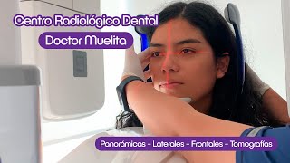 🦷 Ahora en Doctor Muelita contamos con nuestro propio CENTRO RADIOLÓGICO DENTAL [upl. by Esilehc124]