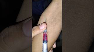 Iv injection basic information about nursing ytshorts shorts nursing trending viralshort [upl. by Ronacin]