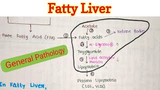 Fatty Liver  Steatosis of Liver  Fatty Change in Liver  General Pathology [upl. by Dranyam]