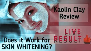 Magical Face Mask Kaolin Clay Review [upl. by Aigil535]