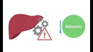 Getting to know albumin physiology [upl. by Amitie792]