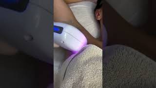 Laser Hair Removal skincare londonaestheticsrejuvenation [upl. by Pyne]