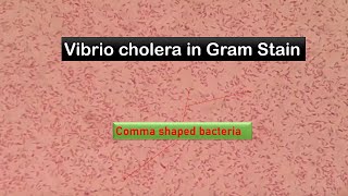 Vibrio cholerae in Gram Stained smear of Culture [upl. by Liamsi708]