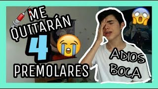 mi terrible EXPERIENCIA con la EXTRACCIÓN de PREMOLARES 😢 LA ICONICA [upl. by Llerraj]