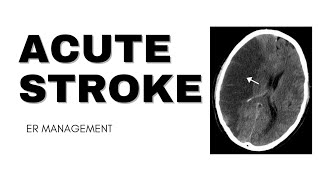 Acute Stroke  ER Management [upl. by Federico453]