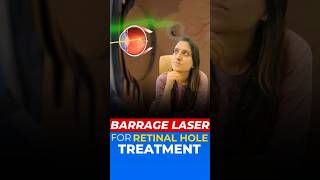 Retinal Hole Treatment with Barrage Laser [upl. by Oulman61]