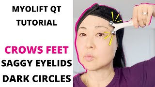 Myolift Qt Tutorial Quick Eye Lift Treatment CROWS FEET DARK CIRCLES AND UNDER EYE BAGS [upl. by Torin267]