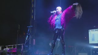 Chicago bands lead singer embraces alopecia with powerful message [upl. by Godber283]