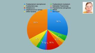 Lemierre’s syndrome – video abstract 95050 [upl. by Kcirred]