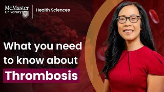 What you need to know about thrombosis [upl. by Quartana]