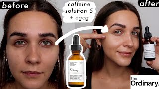 I Tried THE ORDINARY CAFFEINE SOLUTION 5  EGCG for a month  BEFORE AND AFTER  dark circles [upl. by Ralleigh629]