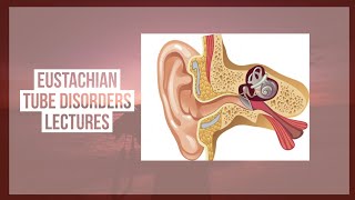 EUSTACHIAN TUBE DISORDERS lecture 4 RETRACTION POCKET and patulous tube made simple [upl. by Ines266]