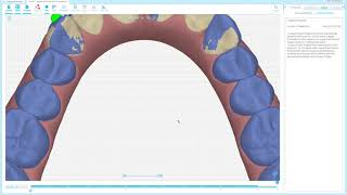 workshop clincheck pro [upl. by Anier]