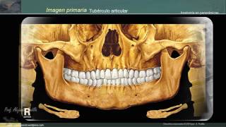 Estructuras anatómicas en la radiografía panorámica [upl. by Ennayt]