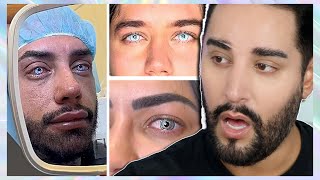 CRAZY PEOPLE risking blindness for vanity  Eye color change surgery [upl. by Kiryt]