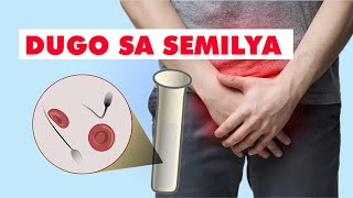 Q amp A DUGO SA SEMILYA HEMATOSPERMIA LUMALAKING ITLOG SPIRULINA ATBP [upl. by Nilauqcaj]