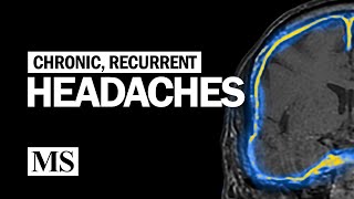 Recurrent and Chronic Headaches [upl. by Everard]