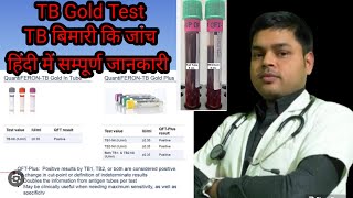 Quantiferon TB Gold test in Hindi  टीबी मरीजों के लिए TB gold टेस्ट क्या है  Result amp Normal value [upl. by Hube]