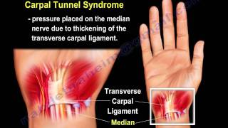 wrist paincauses and treatment PART I Everything You Need To Know  Dr Nabil Ebraheim [upl. by Clawson389]