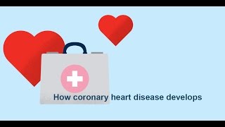 How coronary heart disease atherosclerosis develops  Bupa Health [upl. by Avan860]