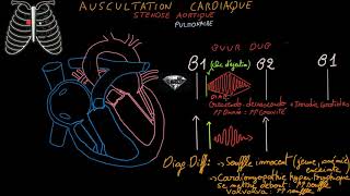 Auscultation cardiaque  Souffles cardiaquesbruits surajoutésExercices  Partie 2 Docteur Synapse [upl. by Erminna]