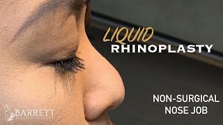 Liquid Rhinoplasty  Non Surgical Nose Job  Barrett Plastic Surgery  Beverly Hills [upl. by Lavelle]