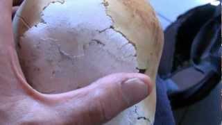 Inside The Elongated Cone Head Skulls Of Paracas Peru [upl. by Enytsirhc]