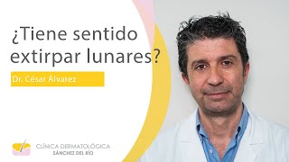 ¿Tiene sentido extirpar lunares de forma preventiva [upl. by Tildi149]