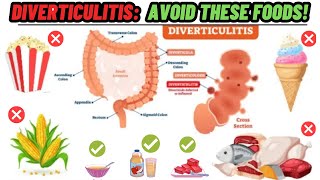 7 Foods To Avoid With Diverticulitis  Diverticulitis Diet  Diverticulitis Foods To Avoid [upl. by Eivlys]