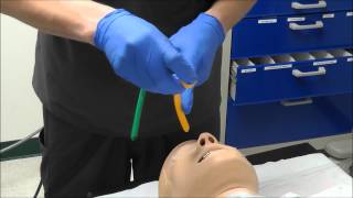 Nasal Intubation [upl. by Arac329]